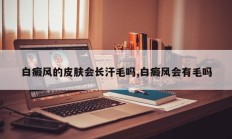 白癜风的皮肤会长汗毛吗,白癜风会有毛吗