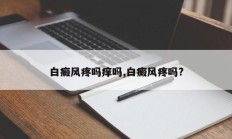 白癜风疼吗痒吗,白癜风疼吗?