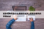 皮肤白癜风是什么原因引起的,皮肤白癜风的早期症状