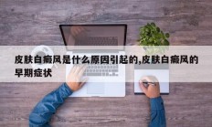 皮肤白癜风是什么原因引起的,皮肤白癜风的早期症状