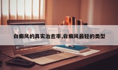 白癜风的真实治愈率,白癜风最轻的类型