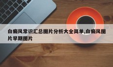 白癜风常识汇总图片分析大全简单,白癜风图片早期图片