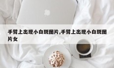 手臂上出现小白斑图片,手臂上出现小白斑图片女