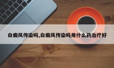 白癜风传染吗,白癜风传染吗用什么药治疗好