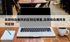 白斑和白癜风的区别在哪里,白斑和白癜风有何区别