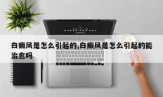 白癜风是怎么引起的,白癜风是怎么引起的能治愈吗