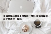 白癜风摸起来和正常皮肤一样吗,白癜风皮肤和正常皮肤一样吗