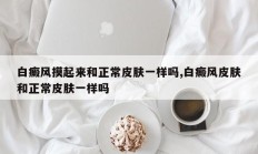 白癜风摸起来和正常皮肤一样吗,白癜风皮肤和正常皮肤一样吗