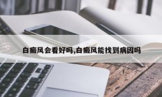 白癜风会看好吗,白癜风能找到病因吗