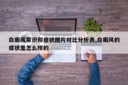 白癜风常识和症状图片对比分析表,白癜风的症状是怎么样的