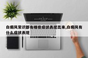 白癜风常识都有哪些症状表现出来,白癜风有什么症状表现