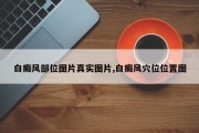 白癜风部位图片真实图片,白癜风穴位位置图