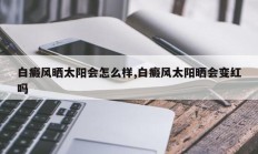 白癜风晒太阳会怎么样,白癜风太阳晒会变红吗