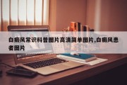 白癜风常识科普图片高清简单图片,白癜风患者图片