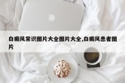 白癜风常识图片大全图片大全,白癜风患者图片