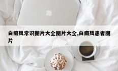 白癜风常识图片大全图片大全,白癜风患者图片
