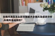 白癜风类型怎么区分图解大全图片及症状分析,白癜风是啥样的?