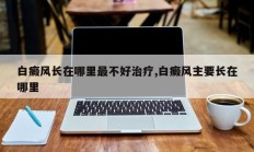 白癜风长在哪里最不好治疗,白癜风主要长在哪里