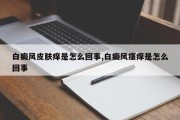 白癜风皮肤痒是怎么回事,白癜风瘙痒是怎么回事