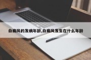 白癜风的发病年龄,白癜风发生在什么年龄
