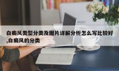 白癜风类型分类及图片详解分析怎么写比较好,白癜风的分类