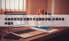白癜风类型区分图片大全图解详解,白癜风各种图片