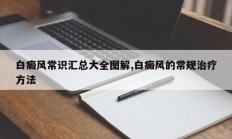 白癜风常识汇总大全图解,白癜风的常规治疗方法