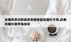 白癜风常识和症状有哪些前兆图片不同,白癜风图片刚开始症状