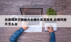 白癜风常识图解大全图片高清简单,白癜风图片怎么治