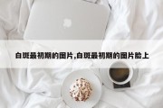 白斑最初期的图片,白斑最初期的图片脸上