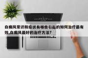 白癜风常识和症状有哪些引起的如何治疗最有效,白癜风最好的治疗方法?