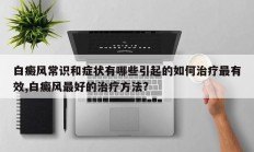 白癜风常识和症状有哪些引起的如何治疗最有效,白癜风最好的治疗方法?