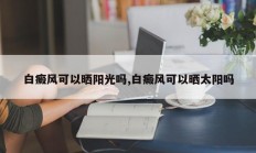 白癜风可以晒阳光吗,白癜风可以晒太阳吗