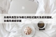 白癜风类型分为哪几种形式图片及症状图解,白癜风病症状图