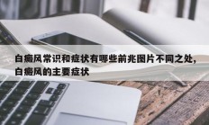 白癜风常识和症状有哪些前兆图片不同之处,白癜风的主要症状