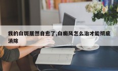 我的白斑居然自愈了,白癜风怎么治才能彻底消除