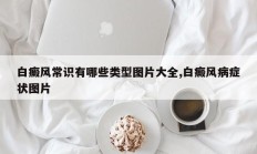 白癜风常识有哪些类型图片大全,白癜风病症状图片