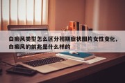 白癜风类型怎么区分初期症状图片女性变化,白癜风的前兆是什么样的