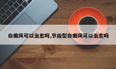 白癜风可以治愈吗,节段型白癜风可以治愈吗