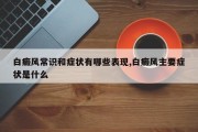 白癜风常识和症状有哪些表现,白癜风主要症状是什么