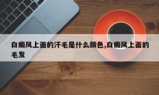 白癜风上面的汗毛是什么颜色,白癜风上面的毛发