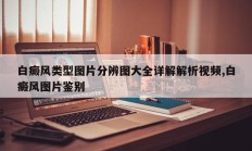 白癜风类型图片分辨图大全详解解析视频,白癜风图片鉴别