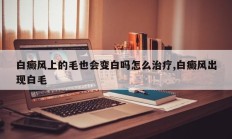 白癜风上的毛也会变白吗怎么治疗,白癜风出现白毛