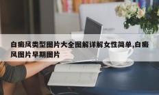 白癜风类型图片大全图解详解女性简单,白癜风图片早期图片