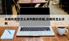 白癜风类型怎么来判断的依据,白癜风怎么诊断