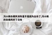 冯小刚白癜风消失是不是因为全白了,冯小刚的白癜风好了没有