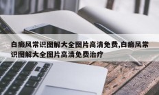 白癜风常识图解大全图片高清免费,白癜风常识图解大全图片高清免费治疗