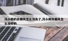 冯小刚的白癜风怎么消失了,冯小刚白癜风怎么治好的