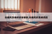 白癜风发病症状有哪些,白癜风的发病诱因