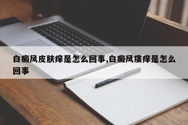 白癜风皮肤痒是怎么回事,白癜风瘙痒是怎么回事